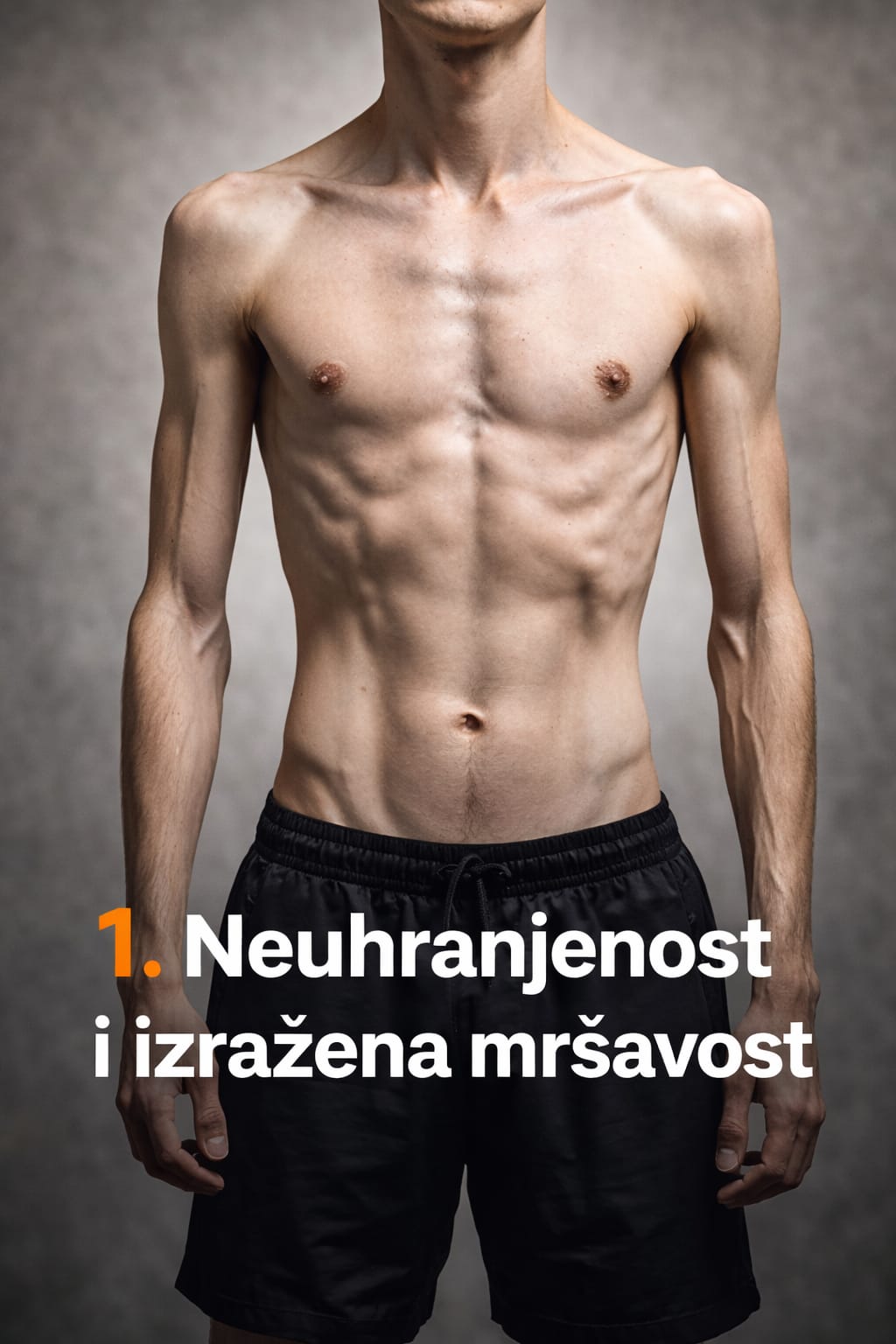 Neuhranjenost i izražena mršavost