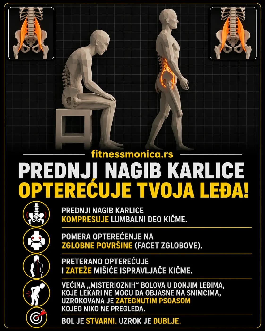 Prednji nagib karlice i opterećenje lumbalnog dela kičme zbog zategnutog psoasa